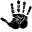 Minimally Invasive Carpal Tunnel Surgery Omaha Nebraska – 10 min Carpal Tunnel Treatment