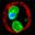 Malaria Site – History, Pathogenesis, Clinical Features, Diagnosis, Treatment, Complications and Control of Malaria