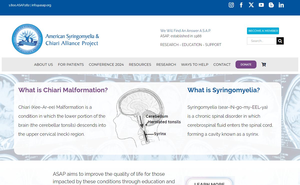 ASAP » American Syringomyelia & Chiari Alliance Project – Chiari malformation and syringomyelia information
