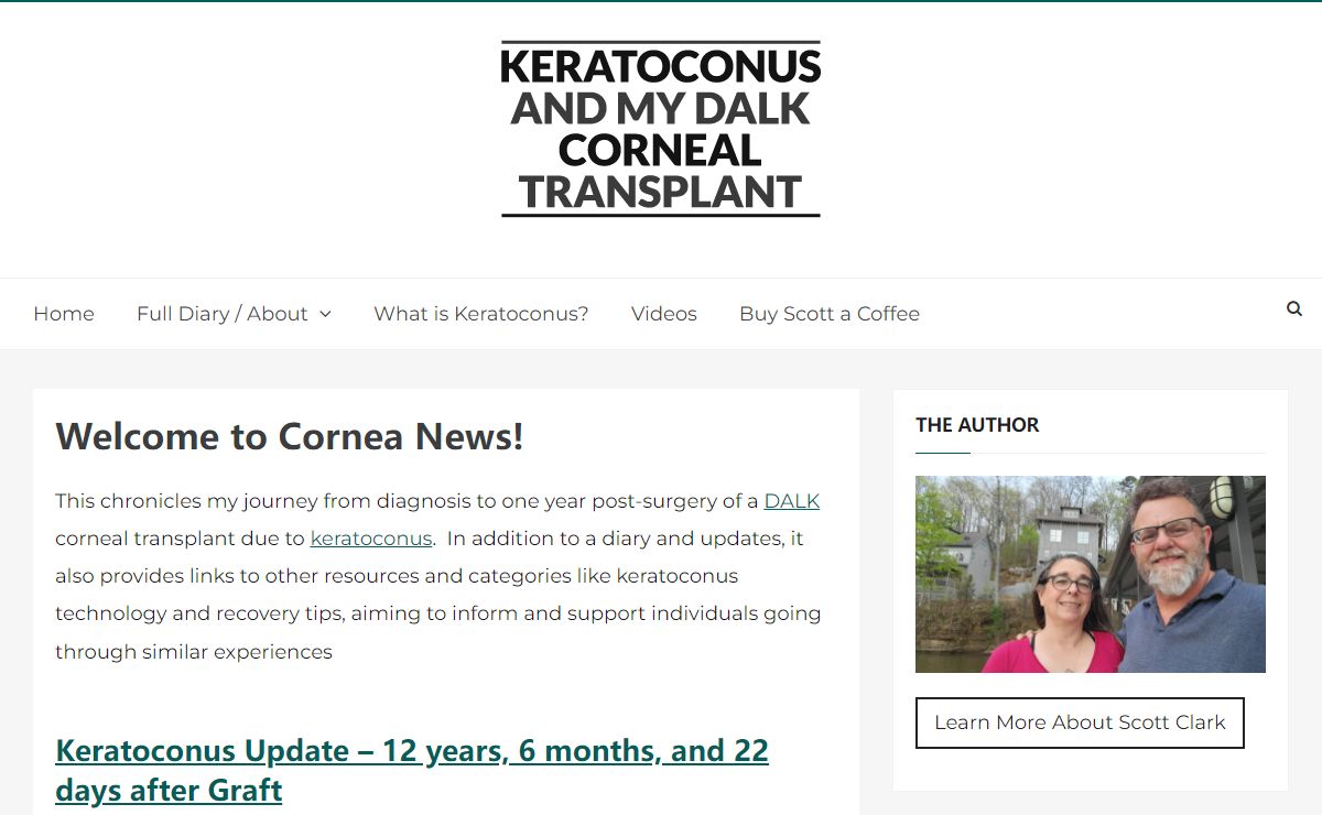 Keratoconus and my DALK Corneal Transplant – My Journey from Diagnosis to Corneal Graft and Beyond