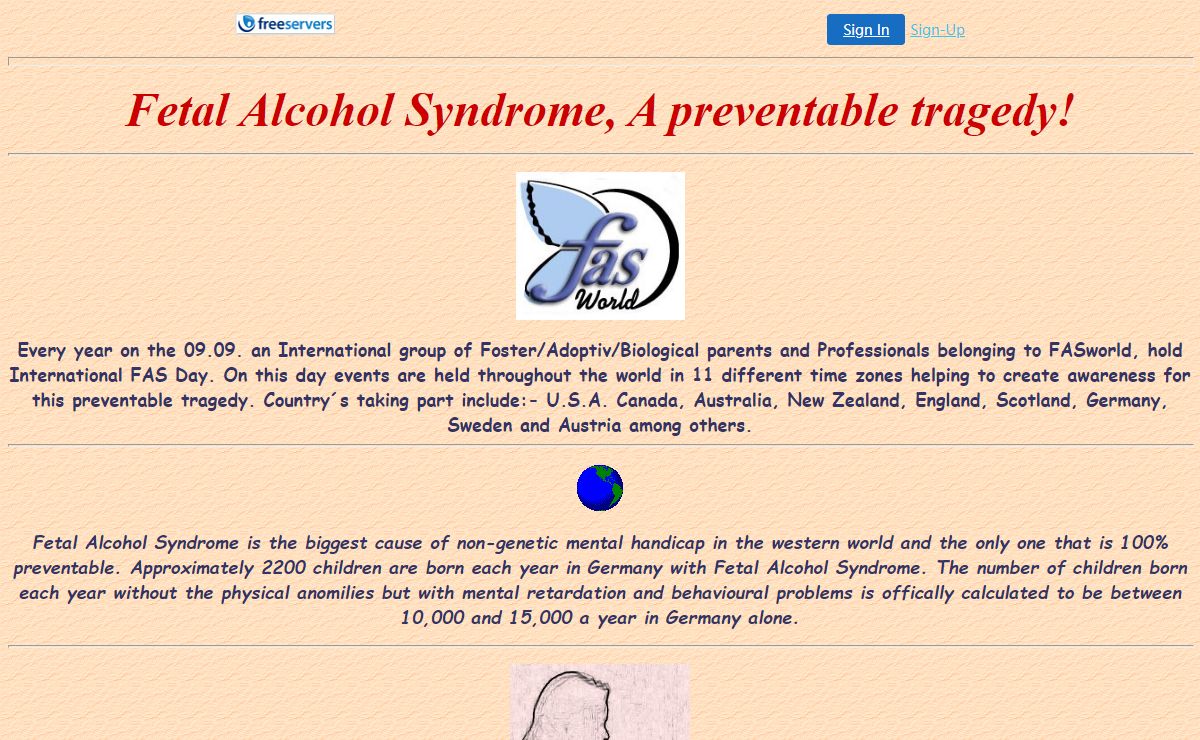 Alcohol in Pregnancy