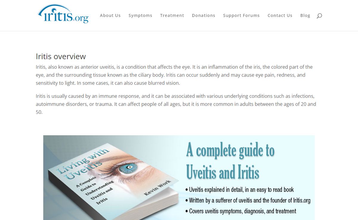 Iritis.org - info on iritis symptoms, iritis treatment, iritis causes