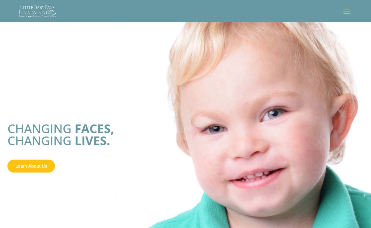 Little Baby Face Foundation | Facial Birth Deformity Corrections