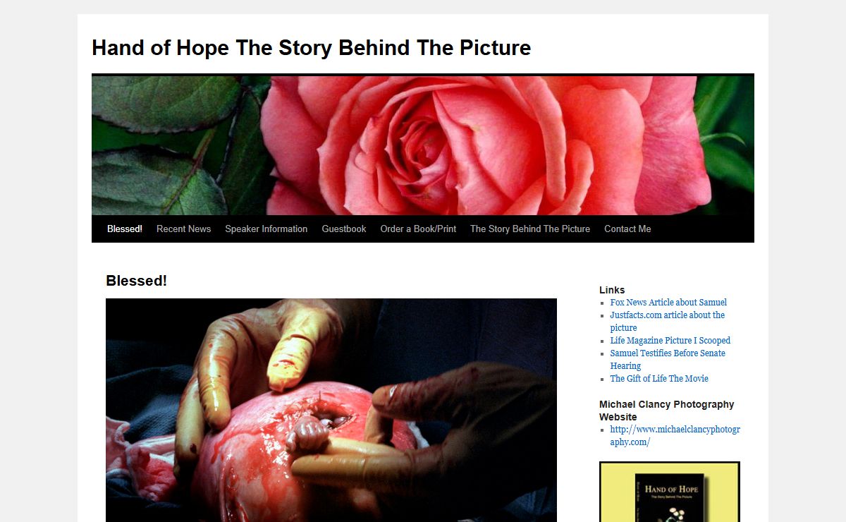 Blessed! - Hand of Hope The Story Behind The PictureHand of Hope The Story Behind The Picture