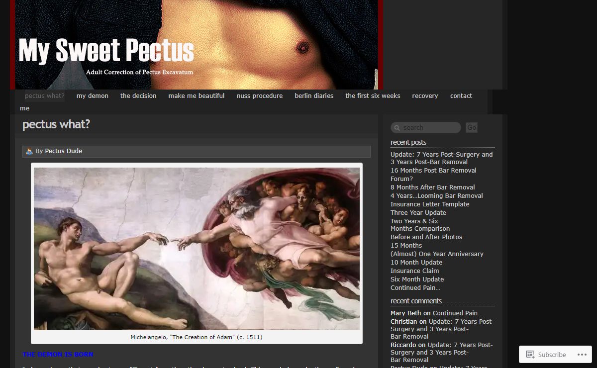 Pectus Excavatum & The Nuss Procedure - Adult Correction of Pectus Excavatum | Pectus Excavatum and Adults