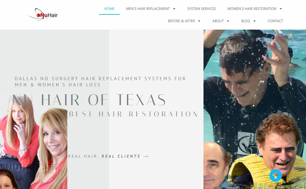 Dallas Hair Replacement System|No Surgery Men/Women Hair Systems Services