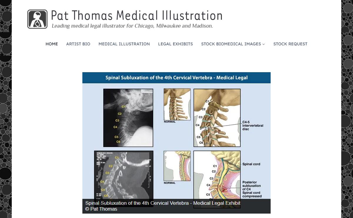 Pat Thomas, CMI, FAMI Board Certified Medical Illustrator – Chicago, Milwaukee and Madison WI. – Leading medical legal illustrator for Chicago, Milwaukee and Madison WI.