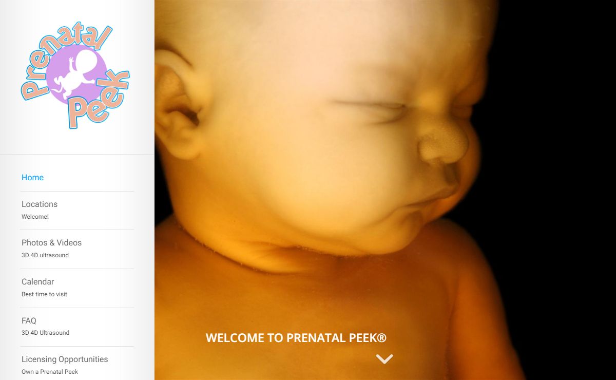 3D 4D Ultrasound – 4D Ultrasound 3D Ultrasound