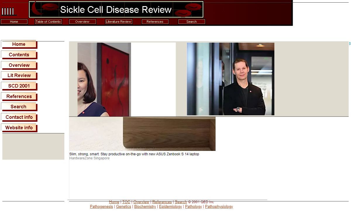 Sickle Cell Disease Review