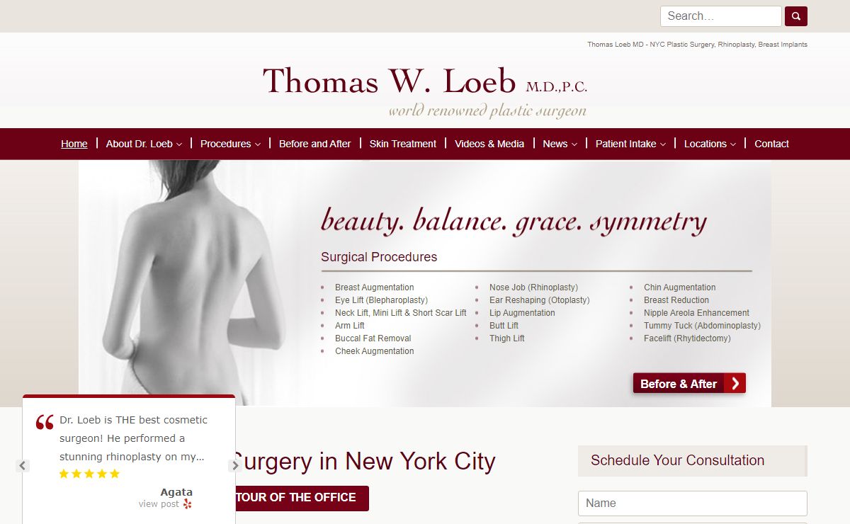 New York Plastic Surgeon | Nasolabial Fold Excision | Rhinoplasty