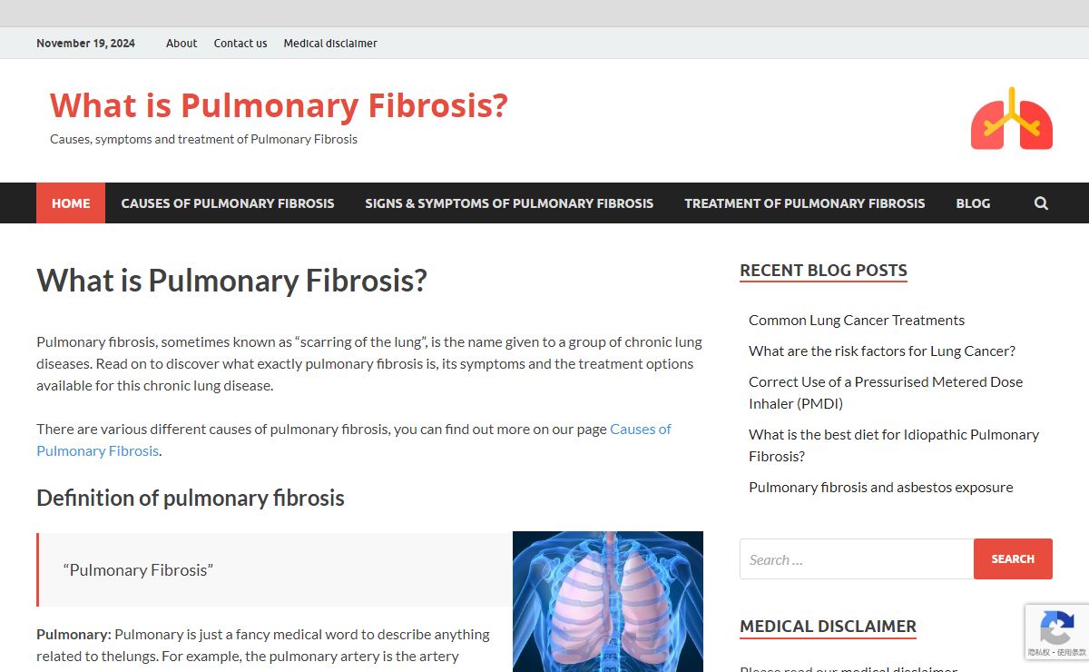 What is Pulmonary Fibrosis? – Causes, symptoms and treatment of Pulmonary Fibrosis