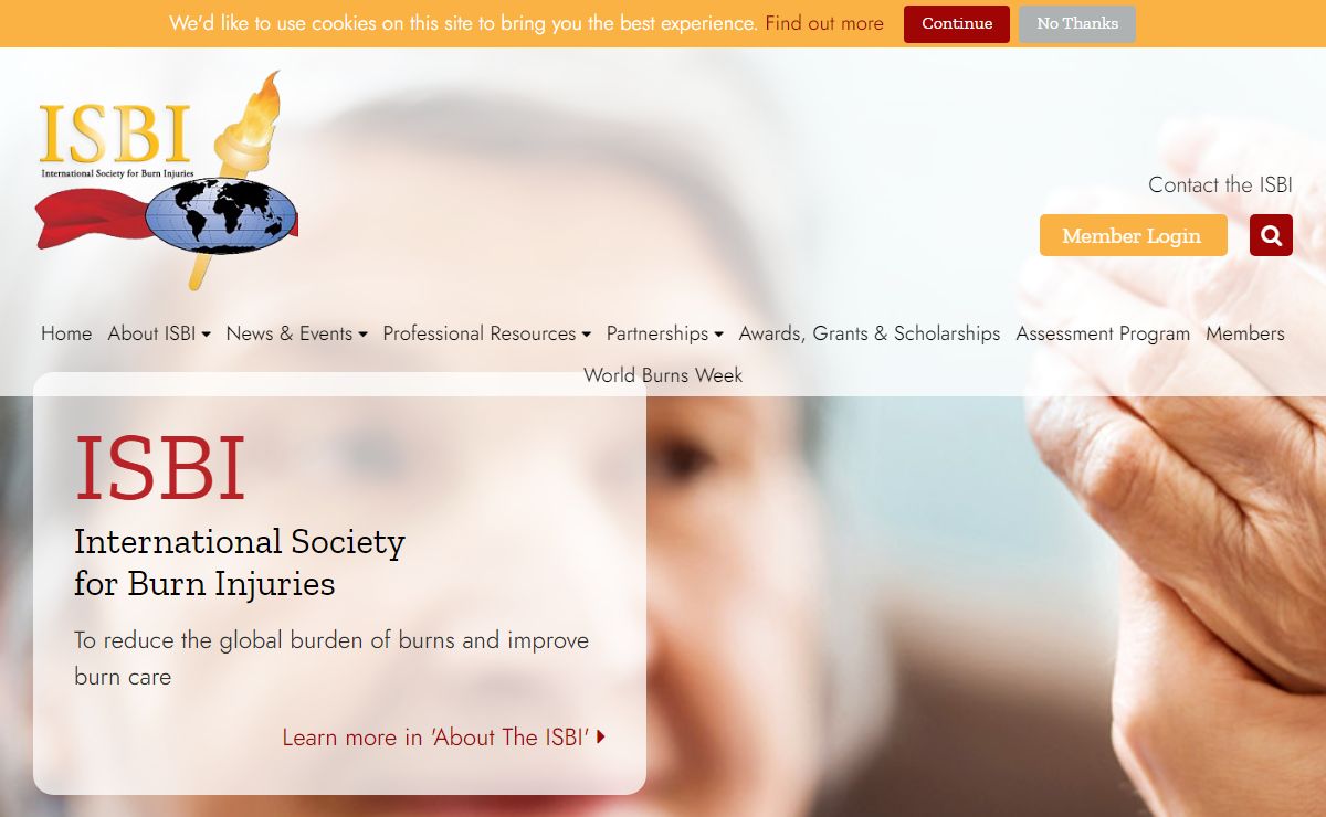 International Society for Burns Injuries