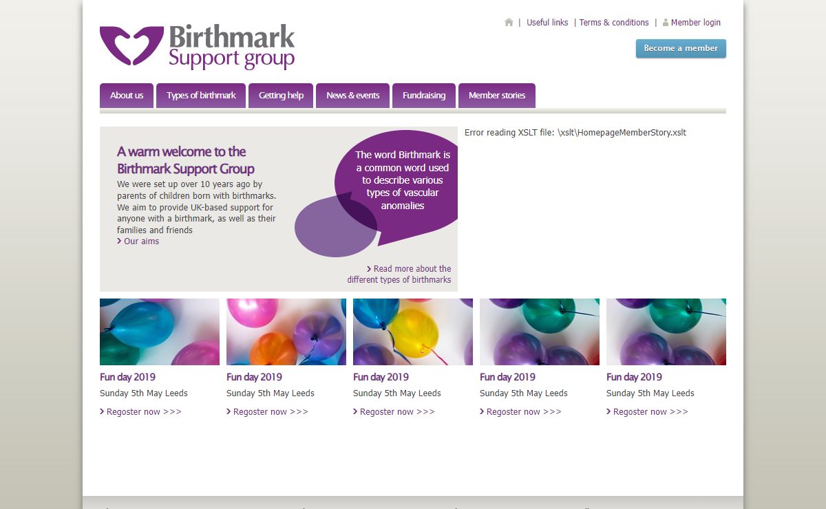 Birthmark Support Group