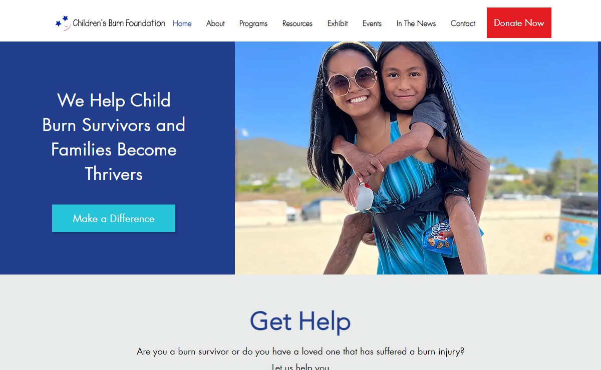 Burn and fire prevention care | Childrens Burn Foundation | Los Angeles