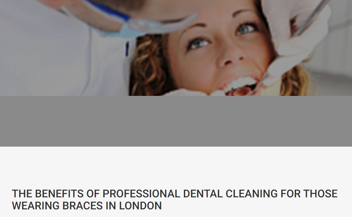 The Benefits Of Professional Dental Cleaning For Those Wearing Braces In London