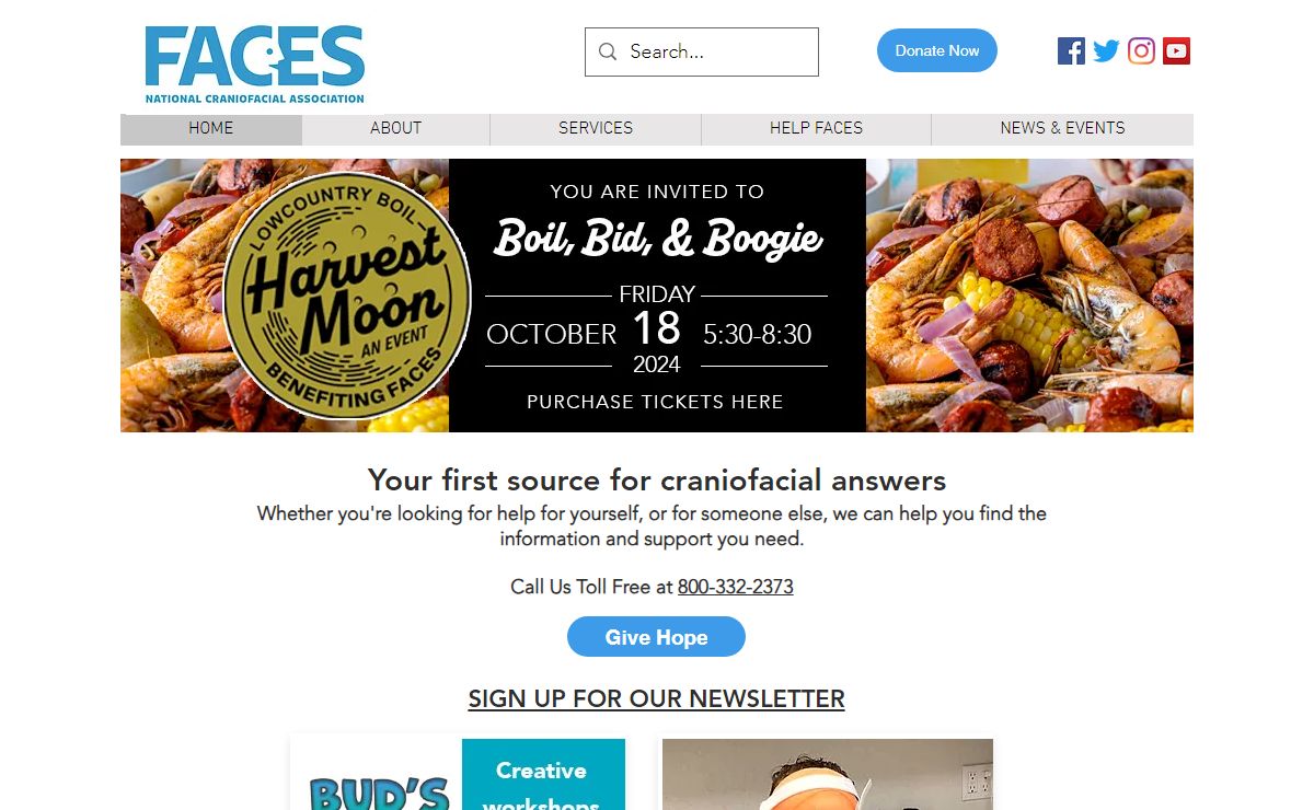 FACES: The National Craniofacial Association | United States