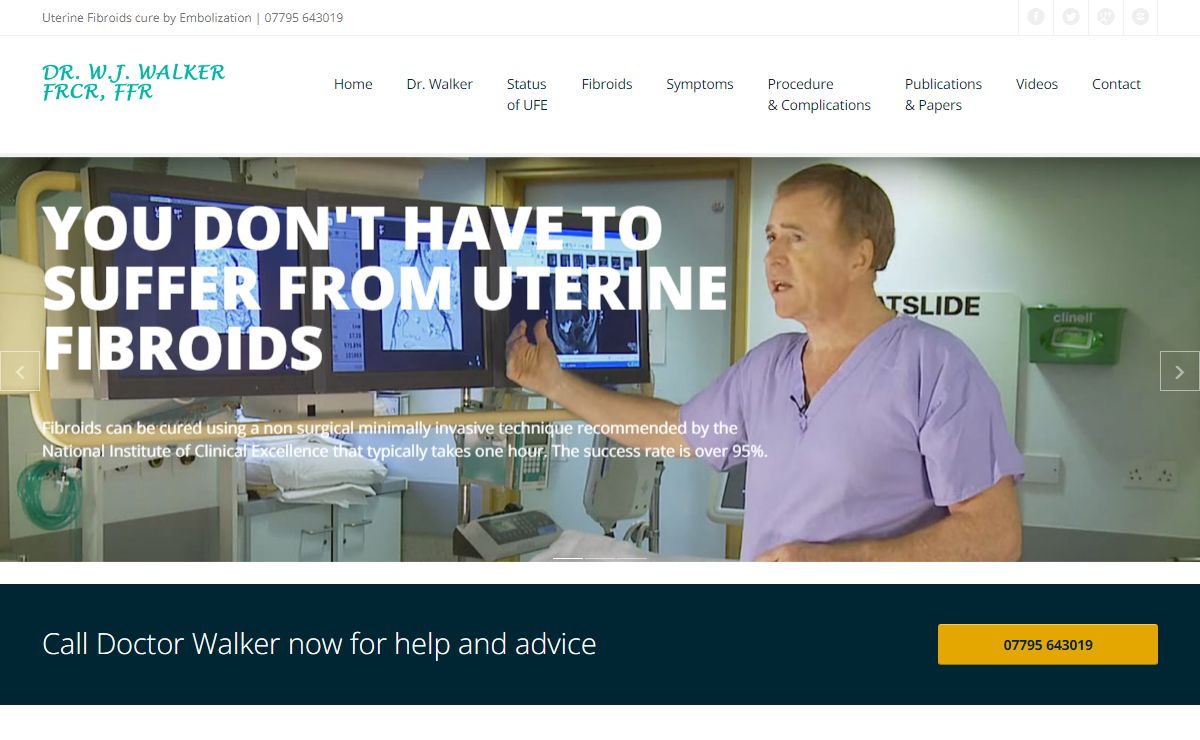 Uterine Fibroids Embolisation by World Renowned Expert Dr. W.J. Walker. London and Surrey Surgeries. NHS.