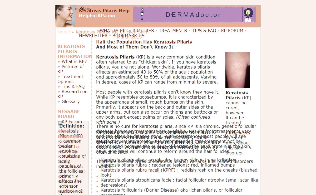 Keratosis Pilaris : The Chicken Skin Condition : Help for KP