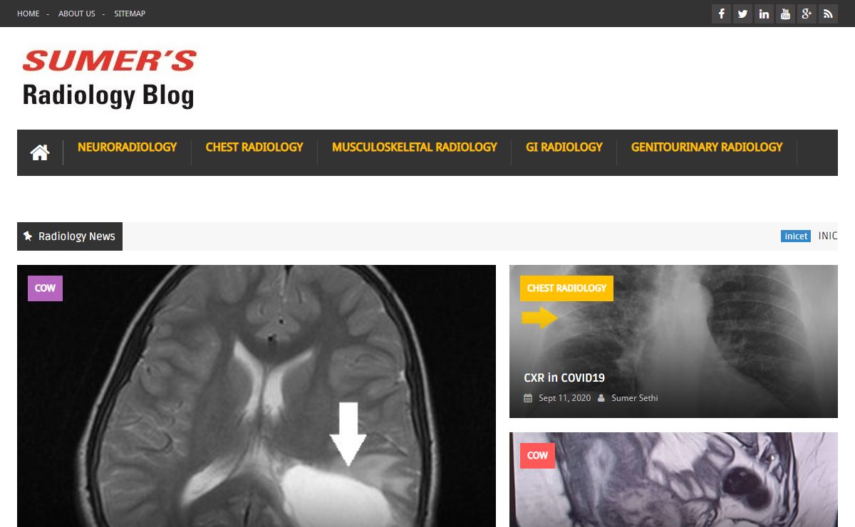 Sumer's Radiology Blog