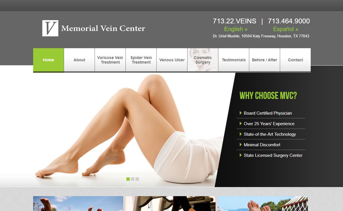 Varicose Veins, Spider Vein Treatment, Memorial Vein Center Houston Texas - Memorial Vein Center Houston Texas