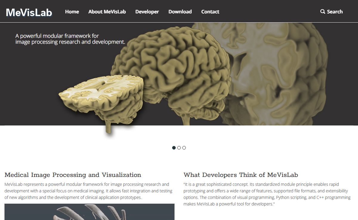 MeVisLab: MeVisLab