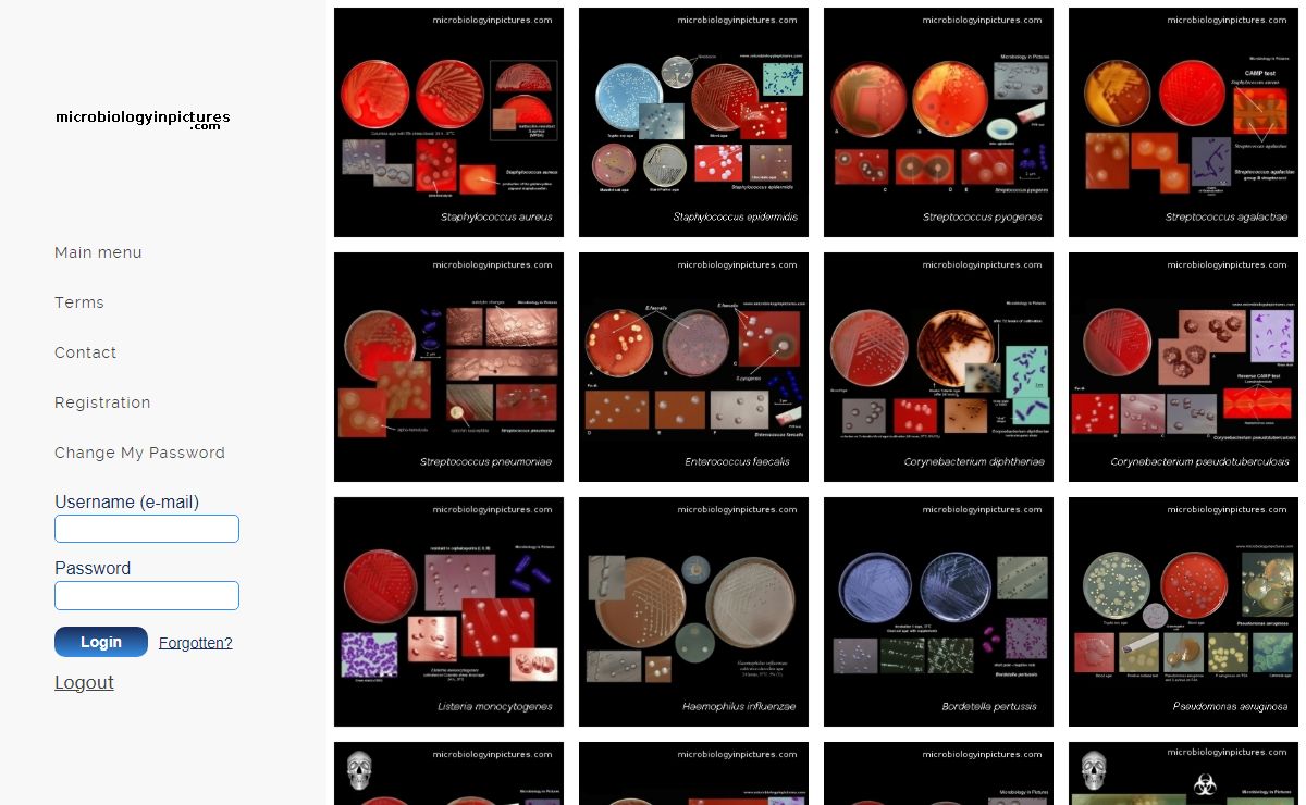 Microbiology pictures - photo gallery of medically important bacteria. Microbiology in pictures, bacteria images and photographs with texts. On-line photo atlas of bacteria.