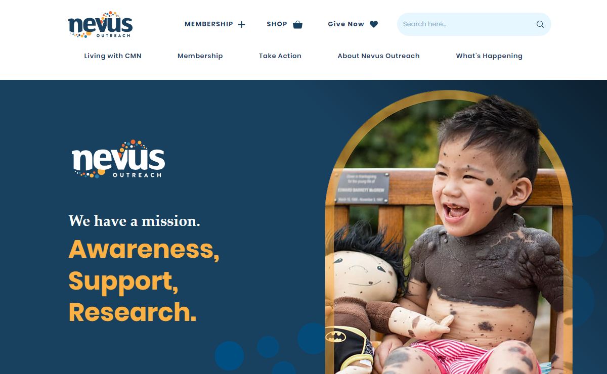 Home | Nevus Outreach