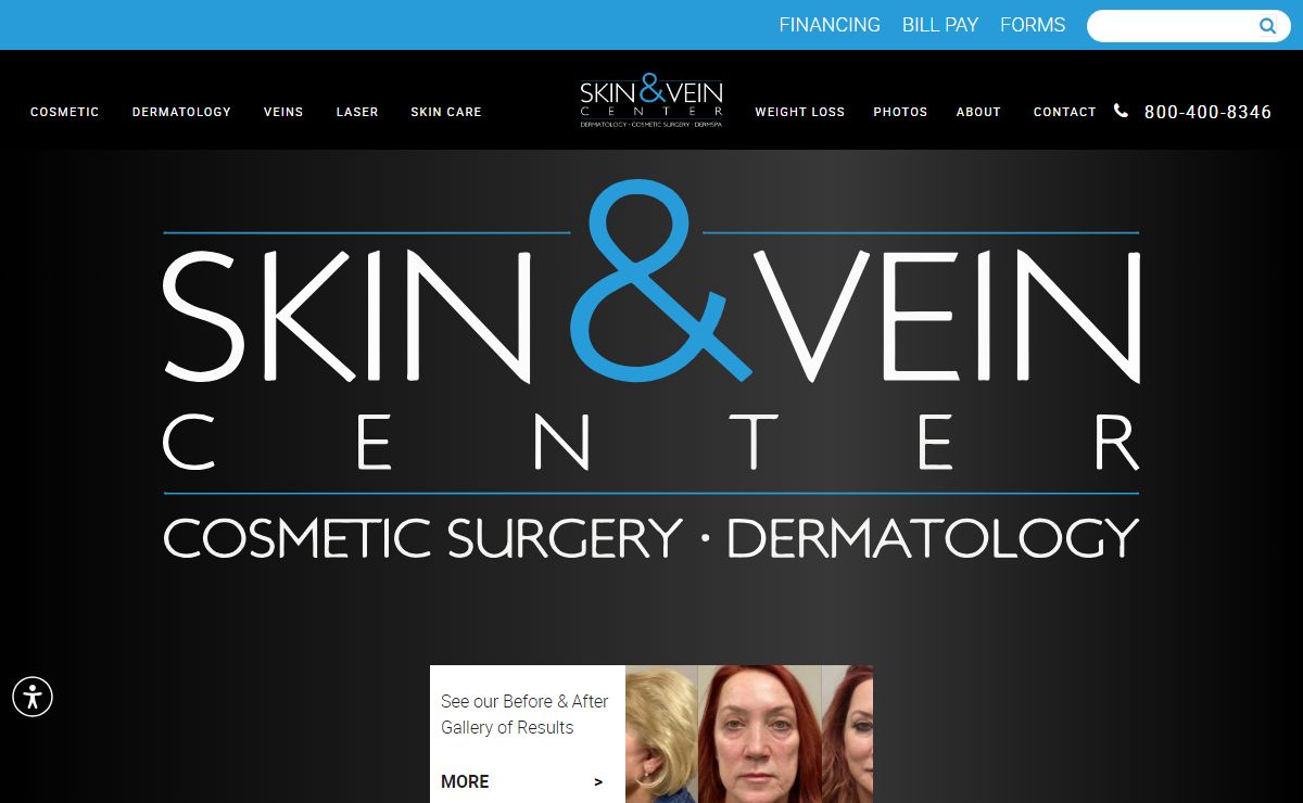 Best Dermatologist Michigan & San Diego, Califorinia| Skin & Vein Center