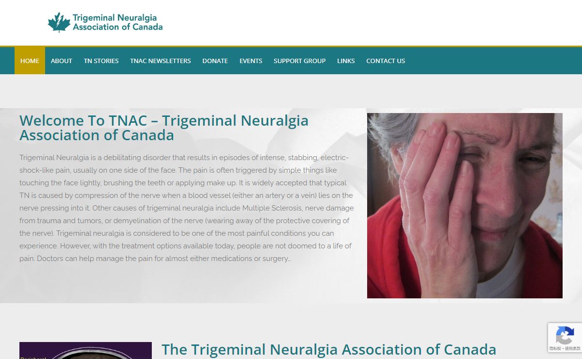 T N A C – Trigeminal Neuralgia Association of Canada – Trigeminal Neuralgia Association of Canada