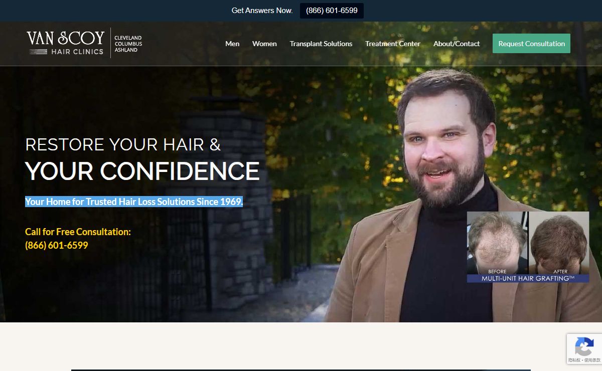 Ohio Hair Restoration & Hair Transplant Experts | Hair Replacement Columbus Cleveland Ashland