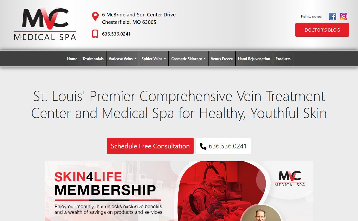 Vein Treatment Services in St. Louis: Spider & Varicose Vein Treatments | Midwest Vein Care